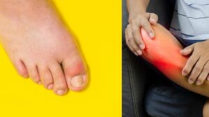 inflamed feet and big toe